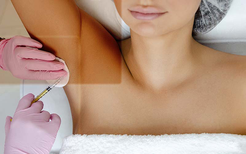 مزایای تزریق بوتاکس زیربغل چیست؟