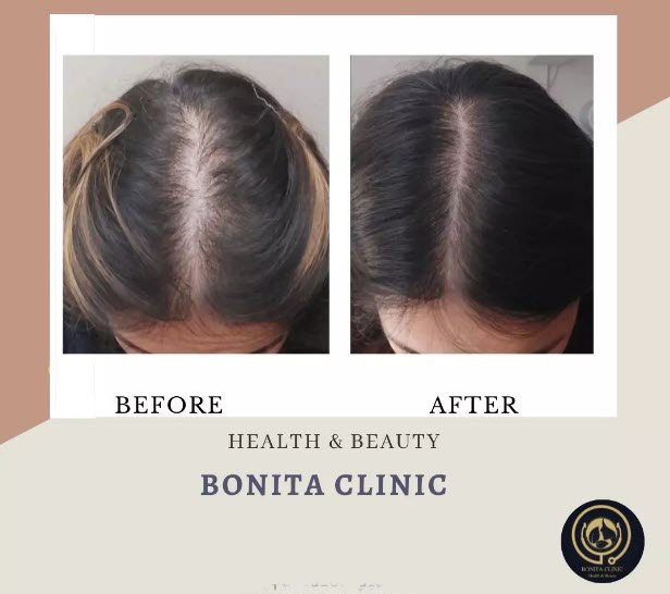 Hair-services-bonitaclinicesf(2) تقویت مو | کلینیک بنیتا اصفهان