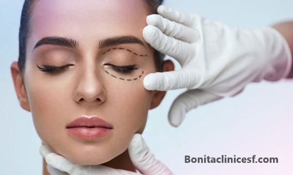 بلفاروپلاستی - کلینیک بنیتا اصفهان