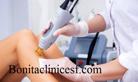 لیزر موهای زائد - کلینیک بنیتا اصفهان