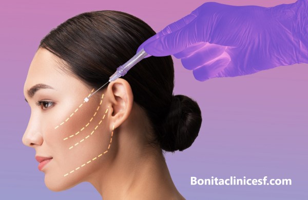 لیفت صورت با نخ - کلینیک بنیتا اصفهان