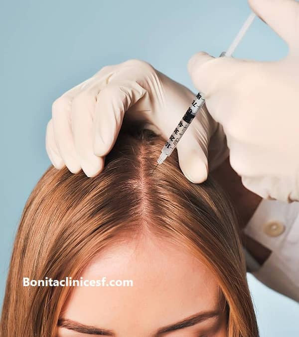 آموزش میکرونیدلینگ و انواع مزوتراپی در اصفهان - کلینیک بنیتا اصفهان