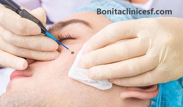 آموزش کار با دستگاه پلاسما و خالبرداری در اصفهان - کلینیک بنیتا اصفهان