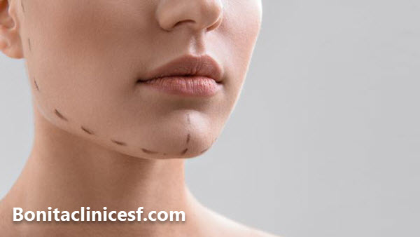 برای تزریق فیلر چانه در اصفهان کجا بریم؟ - کلینیک بنیتا اصفهان