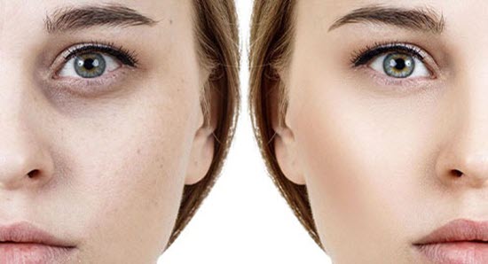 مرکز تخصصی بوتاکس صورت در اصفهان | کلینیک بنیتا اصفهان