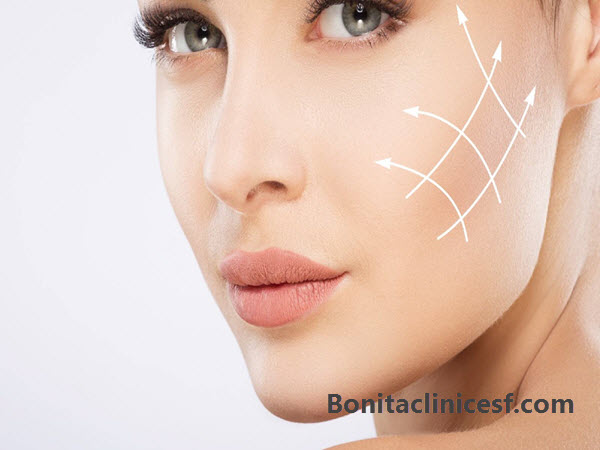 تزریق فیلر گونه در اصفهان - کلینیک بنیتا اصفهان