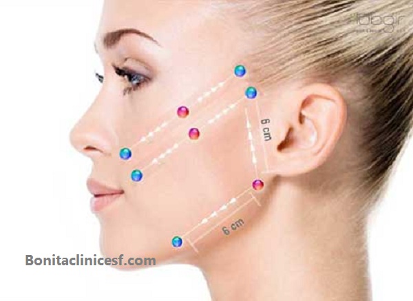 کلینیک زاویه سازی و کانتورینگ در اصفهان - کلینیک بنیتا اصفهان