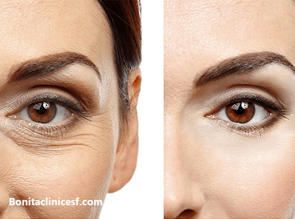 بهترین مرکز جراحی زیبایی در اصفهان | کلینیک بنیتا اصفهان