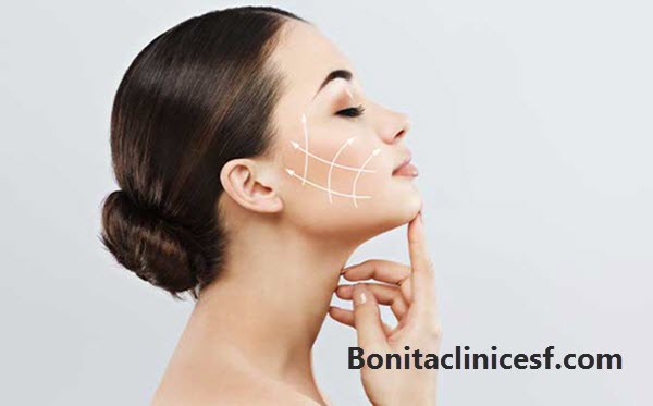 هایفو بهترین روش لیفت صورت - کلینیک بنیتا اصفهان