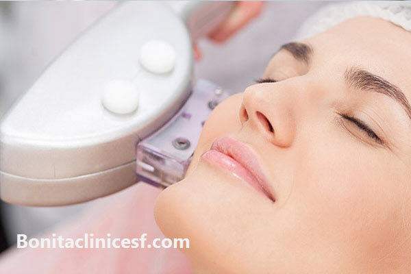 هایفو بهترین روش لیفت صورت - کلینیک بنیتا اصفهان