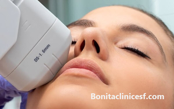 هایفو بهترین روش لیفت صورت - کلینیک بنیتا اصفهان