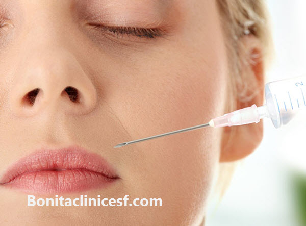 فیلر خط خنده در اصفهان - کلینیک بنیتا اصفهان