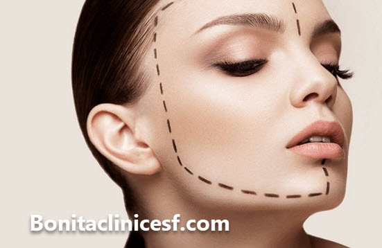 انجام فیلر گونه در اصفهان | کلینیک بنیتا اصفهان