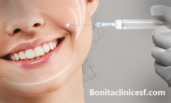 فیلر خط خنده در اصفهان - کلینیک بنیتا اصفهان