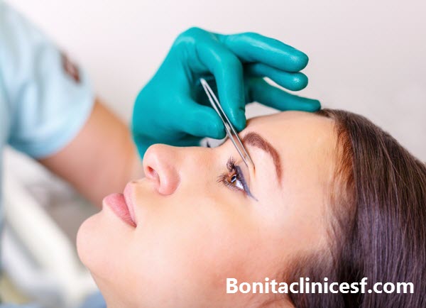 بلفاروپلاستی چیست؟-کلینیک بنیتا در اصفهان