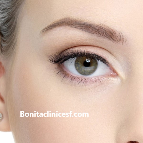 بلفاروپلاستی - کلینیک بنیتا اصفهان