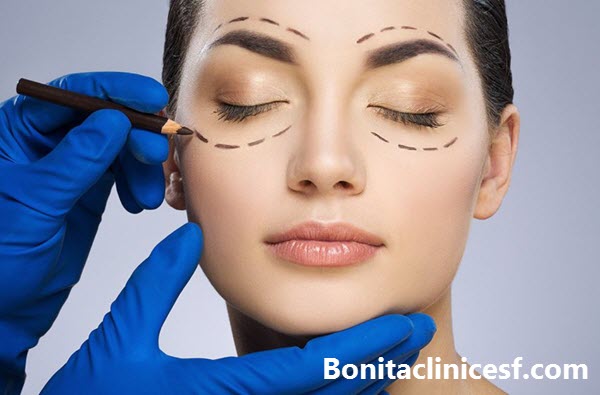 بلفاروپلاستی چیست؟-کلینیک بنیتا اصفهان