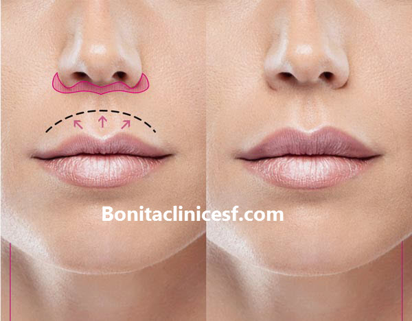 سانترال لب - کلینیک بنیتا اصفهان