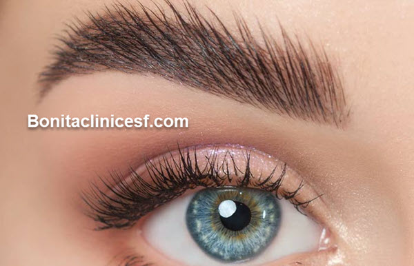 لیفت ابرو | کلینیک بنیتا اصفهان