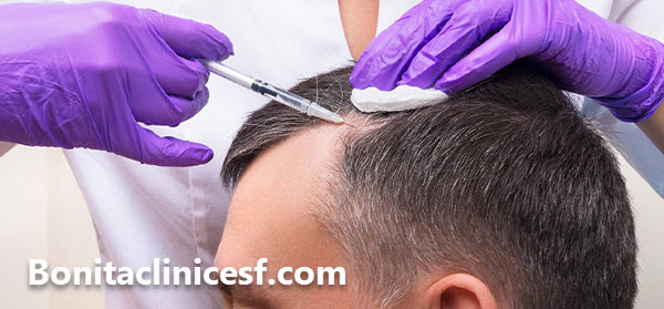 بهترین دکتر کاشت مو در اصفهان - کلینیک بنیتا