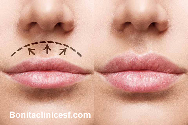 بهترین مرکز سانترال لب در اصفهان - کلینیک بنیتا