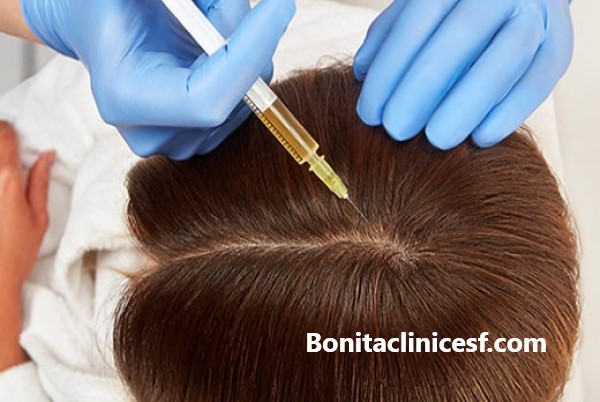 هزینه مزوتراپی مو در اصفهان | کلینیک بنیتا اصفهان