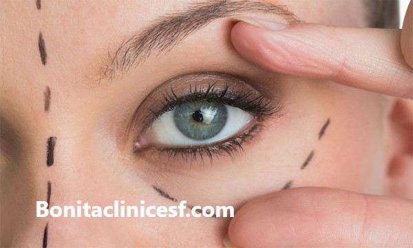 هزینه عمل افتادگی پلک در اصفهان - کلینیک بنیتا اصفهان