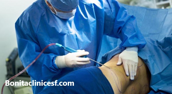 بهترین دکتر پیکر تراشی در اصفهان | کلینیک بنیتا اصفهان