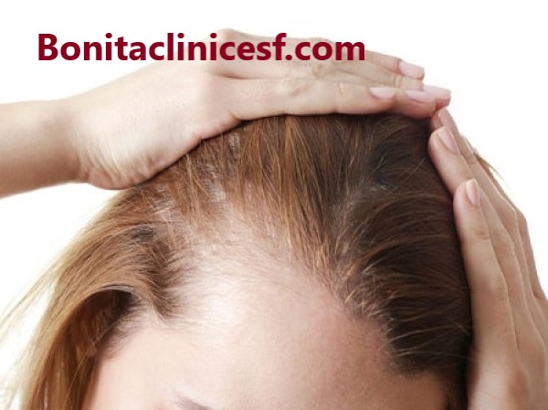 بهترین کلینیک کاشت مو در اصفهان - کلینیک بنیتا اصفهان