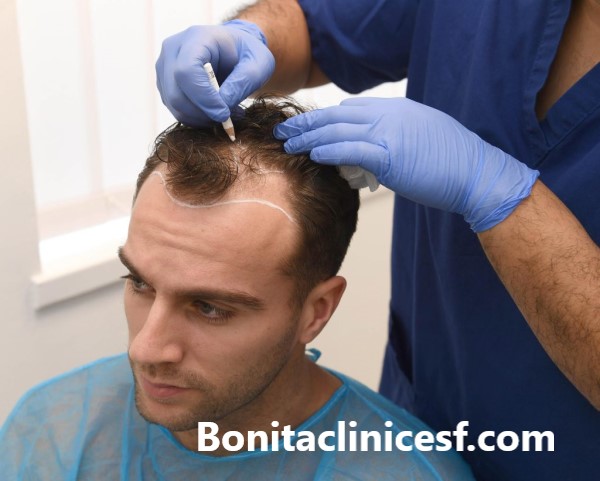 هزینه کاشت موی سر چقدر است؟ - کلینیک بنیتا اصفهان