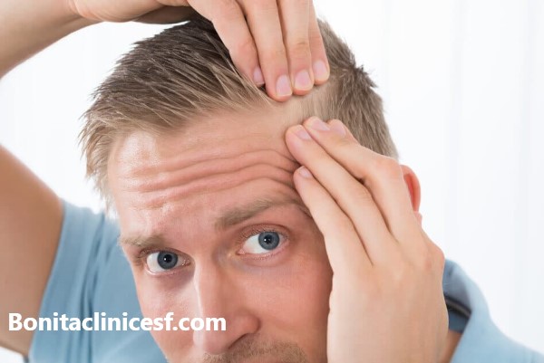 آشنایی با انواع روش های کاشت مو | کلینیک بنیتا اصفهان