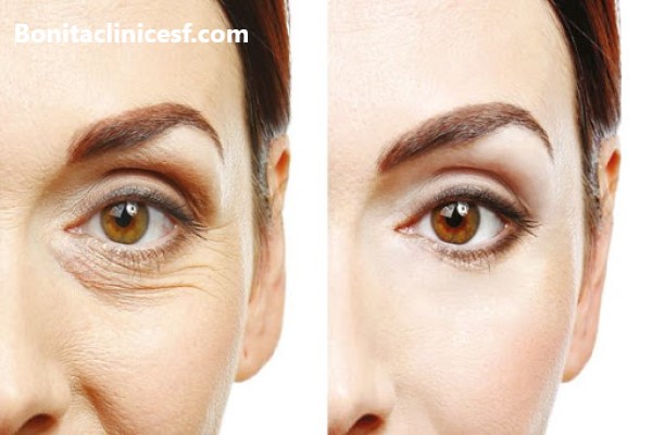 برترین کلینیک تخصصی بلفاروپلاستی در اصفهان - کلینیک بنیتا