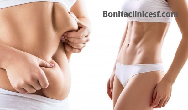 بهترین دکتر پیکر تراشی در اصفهان | کلینیک بنیتا اصفهان