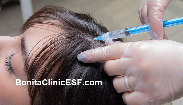 بهترین کلینیک مزوتراپی مو در اصفهان | بنیتا