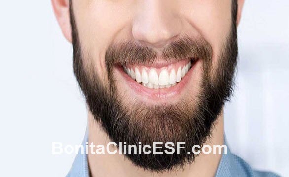 بهترین متخصص کاشت ریش در اصفهان | کلینیک بنیتا