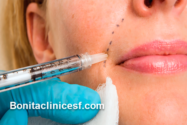 هزینه-تزریق-ژل-در-اصفهان-چقدر-است؟ | کلینیک بنیتا اصفهان