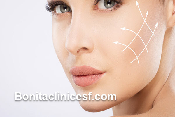 تزریق ژل گونه با قیمت مناسب | کلینیک بنیتا اصفهان