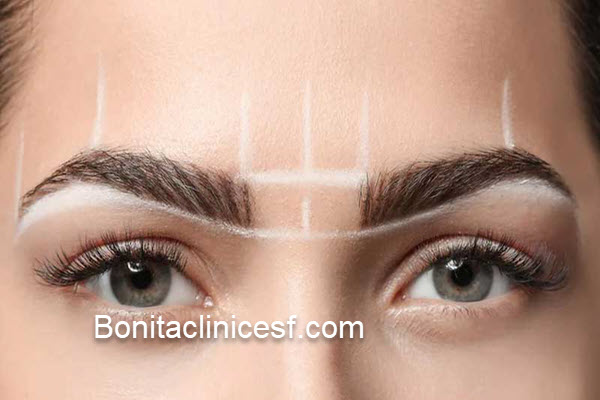 قیمت کاشت ابرو در اصفهان چقدر است؟ | کلینیک بنیتا اصفهان