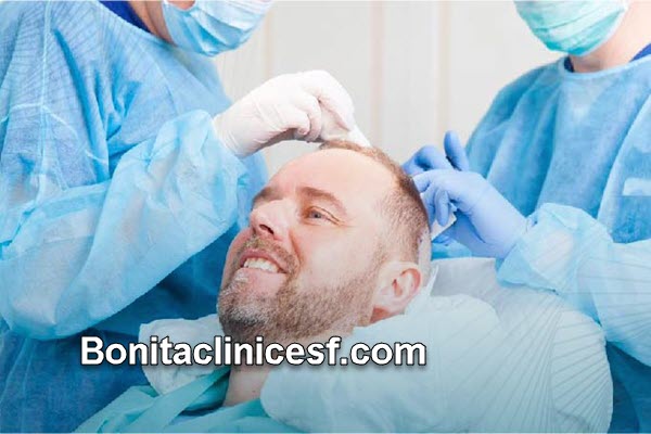 مرکز تخصصی کاشت مو بدون جراحی در اصفهان | کلینیک بنیتا اصفهان