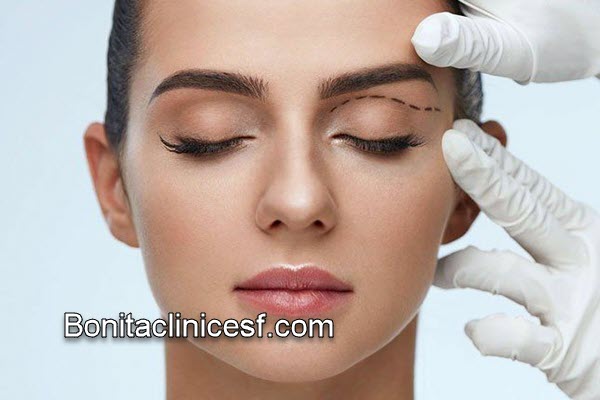 آشنایی با جراحی بلفاروپلاستی پلک بالا با قیمت مناسب در اصفهان