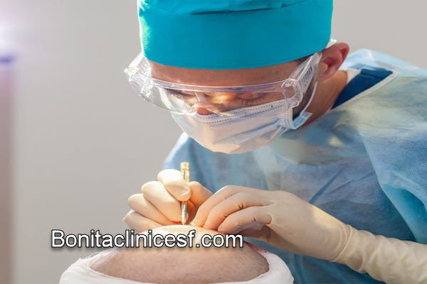 آشنایی با کلینیک تخصصی کاشت موی طبیعی در اصفهان