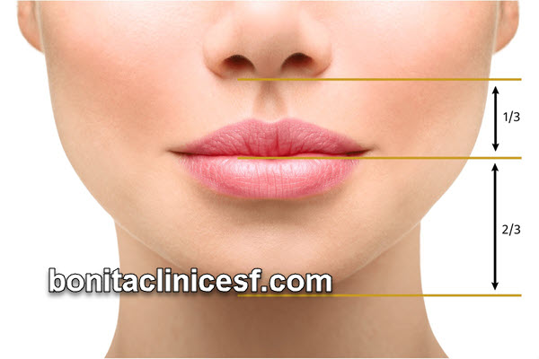 دکتر خوب برای لیفت سانترال لب در اصفهان | کلینیک بنیتا اصفهان