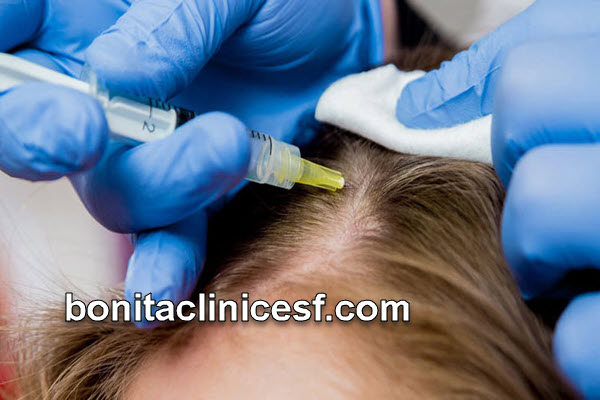 مزوتراپی مو چند جلسه است؟ | کلینیک بنیتا اصفهان