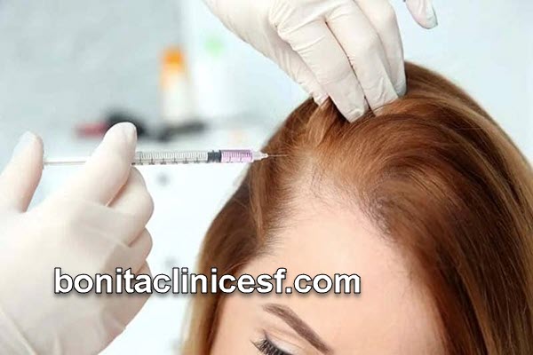 ماندگاری مزوتراپی مو چقدر است؟ | کلینیک بنیتا اصفهان