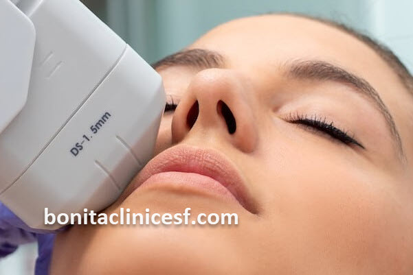 ماندگاری هایفوتراپی صورت چقدر است؟ | کلینیک بنیتا