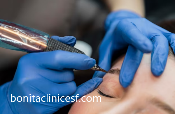 برترین متد کاشت ابرو به روش میکروگرافت در اصفهان | کلینیک بنیتا