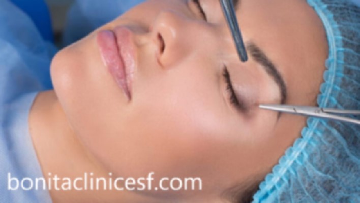 آشنایی با مراقبت های بعد از عمل بلفاروپلاستی | کلینیک بنیتا