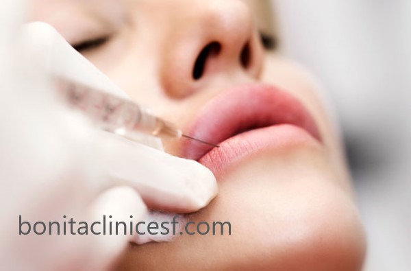 هزینه تزریق ژل لب در اصفهان | کلینیک بنیتا