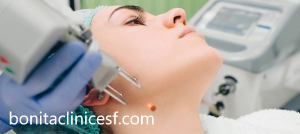 روش های نوین برداشت خال در اصفهان | کلینیک بنیتا اصفهان