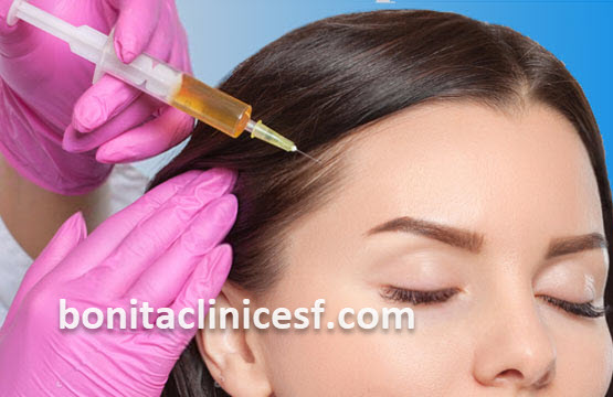 پی آر پی مو (PRP) | کلینیک بنیتا اصفهان